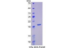 SDS-PAGE of Protein Standard from the Kit (Highly purified E. (REG3g ELISA Kit)