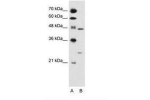 Image no. 1 for anti-Retinoid X Receptor, gamma (RXRG) (AA 101-150) antibody (ABIN6736682) (Retinoid X Receptor gamma antibody  (AA 101-150))