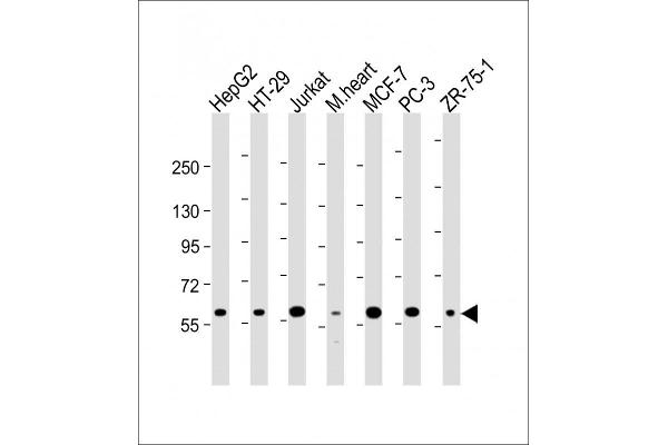 DCLRE1C antibody  (N-Term)