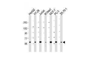 All lanes : Anti-DCLRE1C Antibody (N-term) at 1:2000 dilution Lane 1: HepG2 whole cell lysate Lane 2: HT-29 whole cell lysate Lane 3: Jurkat whole cell lysate Lane 4: mouse heart lysate Lane 5: MCF-7 whole cell lysate Lane 5: PC-3 whole cell lysate Lane 5: ZR-75-1 whole cell lysate Lysates/proteins at 20 μg per lane.