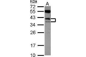 WB Image Sample (30 ug of whole cell lysate) A: K562 12% SDS PAGE antibody diluted at 1:1000 (CD79b antibody  (Center))