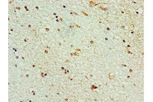 Immunohistochemistry of paraffin-embedded human brain tissue using ABIN7168991 at dilution of 1:100 (STK32A antibody  (AA 1-166))