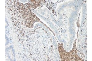 Immunohistochemistry (IHC) image for anti-Interleukin 5 (IL5) antibody (Biotin) (ABIN2475028) (IL-5 antibody  (Biotin))