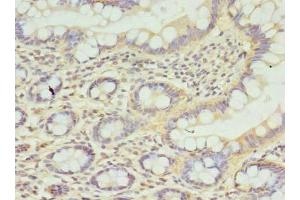 Immunohistochemistry of paraffin-embedded human small intestine tissue using ABIN7146249 at dilution of 1:100 (CPED1 antibody  (AA 221-472))