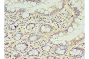 Immunohistochemistry of paraffin-embedded human small intestine tissue using ABIN7146249 at dilution of 1:100 (CPED1 antibody  (AA 221-472))