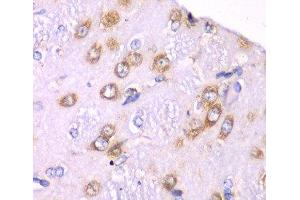 Immunohistochemistry of paraffin-embedded Rat brain using RPS3A Polyclonal Antibody at dilution of 1:100 (40x lens). (RPS3A antibody)