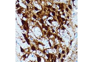 Immunohistochemistry of paraffin-embedded mouse brain using Parvalbumin (PVALB) (PVALB) Rabbit mAb (ABIN7269182) at dilution of 1:100 (40x lens). (PVALB antibody)