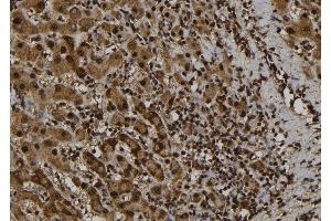 ABIN6277753 at 1/100 staining Human liver tissue by IHC-P.