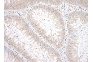 anti-tyrosyl-DNA phosphodiesterase 2 (TDP2) (AA 50-100) antibody
