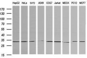 Image no. 2 for anti-Retinoic Acid Receptor Responder (Tazarotene Induced) 1 (RARRES1) antibody (ABIN1500602) (RARRES1 antibody)