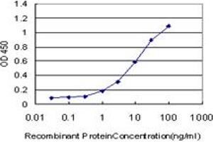 Detection limit for recombinant GST tagged ERN1 is approximately 0. (ERN1 antibody  (AA 401-500))