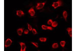 ABIN6266569 staining HepG2 by IF/ICC. (KRT16 antibody  (C-Term))