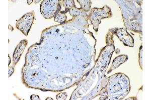 Immunohistochemistry (IHC) image for anti-Tetraspanin 12 (TSPAN12) (AA 111-224) antibody (ABIN5693040)