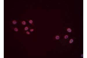 ABIN6277494 staining Hela cells by IF/ICC. (FOXP1 antibody  (C-Term))