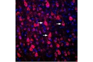 Expression of DRD1 in rat cortexImmunohistochemical staining of perfusion-fixed frozen rat brain sections using Guinea pig Anti-D1 Dopamine Receptor Antibody (ABIN7043106, ABIN7045428 and ABIN7045429), (1:300), followed by goat-anti-guinea pig-Cy3 antibody.