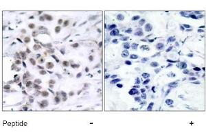 Image no. 1 for anti-Checkpoint Kinase 1 (CHEK1) (Ser317) antibody (ABIN197292) (CHEK1 antibody  (Ser317))