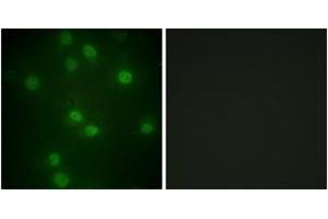 Immunofluorescence analysis of HuvEc cells, using Retinoblastoma (Phospho-Ser811) Antibody. (Retinoblastoma Protein (Rb) antibody  (pSer811))