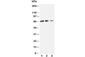 Western blot testing of CX3CL1 antibody and Lane 1:  recombinant mouse protein 10ng;  2: 5ng;  3: 2. (CX3CL1 antibody  (N-Term))