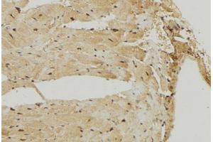 ABIN6274722 at 1/100 staining Mouse muscle tissue by IHC-P. (MRPS7 antibody)