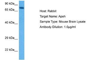 Host: Rabbit Target Name: APEH Sample Tissue: Mouse Brain Antibody Dilution: 1ug/ml