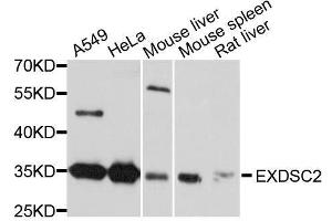 Western blot analysis of extracts of various cell lines, using EXOSC2 antibody. (EXOSC2 antibody  (AA 1-293))