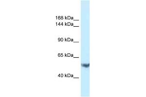 Host: Rabbit Target Name: EPHA1 Sample Type: PANC1 Whole Cell lysates Antibody Dilution: 1. (EPHA1 antibody  (C-Term))