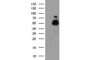 HEK293T cells were transfected with the pCMV6-ENTRY control (Left lane) or pCMV6-ENTRY TUBAL3 (Right lane) cDNA for 48 hrs and lysed. (TUBAL3 antibody  (AA 150-446))