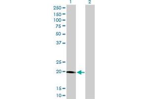 Western Blot analysis of STK32A expression in transfected 293T cell line by STK32A monoclonal antibody (M01), clone 3E8-1D3. (STK32A antibody  (AA 1-166))