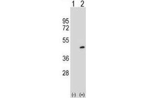 Western blot analysis of PRMT6 antibody and 293 cell lysate either nontransfected (Lane 1) or transiently transfected (2) with the PRMT6 gene. (PRMT6 antibody  (AA 19-48))
