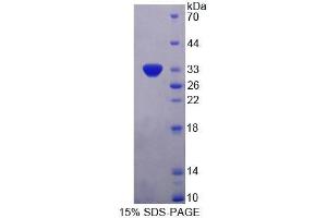 SDS-PAGE analysis of Human PLIN4 Protein. (PLIN4 Protein)