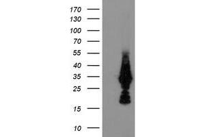 HEK293T cells were transfected with the pCMV6-ENTRY control (Left lane) or pCMV6-ENTRY MMACHC (Right lane) cDNA for 48 hrs and lysed. (MMACHC antibody)