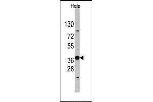 Image no. 1 for anti-Ectodysplasin A (EDA) (N-Term) antibody (ABIN358789) (Ectodysplasin A antibody  (N-Term))
