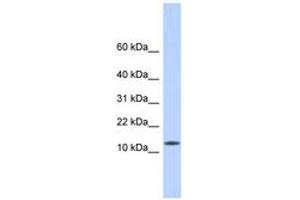 Image no. 1 for anti-CMT1A Duplicated Region Transcript 4 (CDRT4) (AA 35-84) antibody (ABIN6743857) (CDRT4 antibody  (AA 35-84))