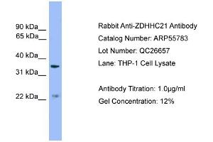 WB Suggested Anti-ZDHHC21  Antibody Titration: 0. (ZDHHC21 antibody  (Middle Region))