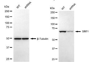 Western blotting analysis using GBE1 antibody (ABIN7798727). (GBE1 antibody)