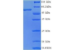 SDS-PAGE (SDS) image for Guanine Nucleotide Binding Protein (G Protein), beta 5 (GNB5) (AA 1-353), (Isoform 2) protein (His-SUMO Tag) (ABIN5709597)