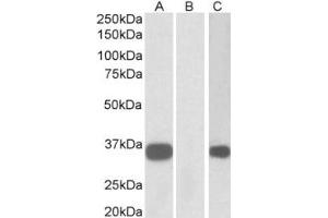 Western Blotting (WB) image for anti-Abhydrolase Domain Containing 14B (ABHD14B) (Internal Region) antibody (ABIN2465095) (ABHD14B antibody  (Internal Region))