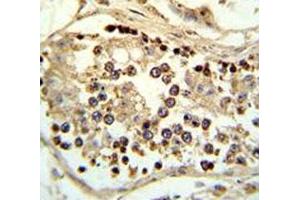 IHC analysis of FFPE human testis tissue stained with ABHD12 antibody (ABHD12 antibody  (AA 40-66))