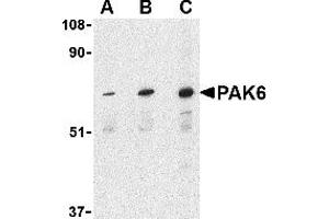 Western Blotting (WB) image for anti-P21-Activated Kinase 6 (PAK6) (Middle Region) antibody (ABIN1031032) (PAK6 antibody  (Middle Region))