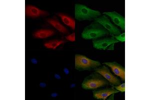 ABIN7093965 and ABIN7098009 staining  cells by IF/ICC.