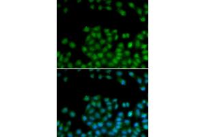 Immunofluorescence analysis of HeLa cells using SFRP2 antibody (ABIN5973117).