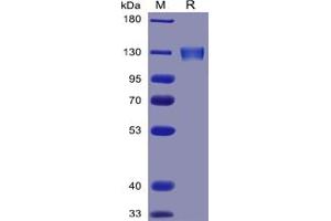 Human ACE2 Protein, mFc Tag on SDS-PAGE under reducing condition. (ACE2 Protein (mFc Tag))