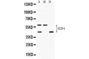 Western Blotting (WB) image for anti-E2F Transcription Factor 4, P107/p130-Binding (E2F4) (AA 106-144), (N-Term) antibody (ABIN4886566)
