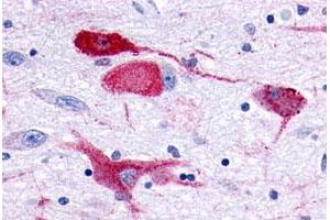 Immunohistochemical (Formalin/PFA-fixed paraffin-embedded sections) staining in human brain, neurons and glia with GPR83 polyclonal antibody . (GPR83 antibody  (1st Extracellular Domain))