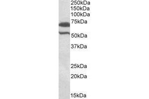 Western Blotting (WB) image for anti-Baculoviral IAP Repeat Containing 3 (BIRC3) (Internal Region) antibody (ABIN2464738) (BIRC3 antibody  (Internal Region))
