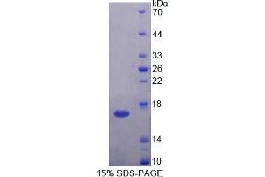 Image no. 1 for H2A Histone Family, Member V (H2AFV) (AA 3-128) protein (His tag) (ABIN4990837) (H2AFV Protein (AA 3-128) (His tag))