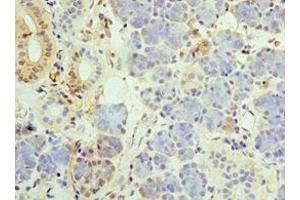 Immunohistochemistry of paraffin-embedded human pancreatic tissue using ABIN7159831 at dilution of 1:100 (UCP1 antibody  (AA 1-307))