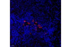 Immunofluorescence of paraffin embedded rat spleen using CNG1 (ABIN7073608) at dilution of 1:700 (400x lens) (CNGA1 antibody)