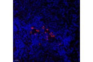 Immunofluorescence of paraffin embedded rat spleen using CNG1 (ABIN7073608) at dilution of 1:700 (400x lens) (CNGA1 antibody)