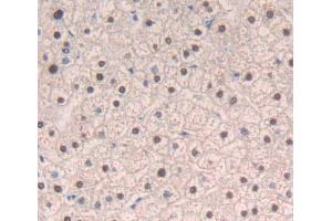 Used in DAB staining on fromalin fixed paraffin- embedded liver tissue (DIDO1 antibody  (AA 258-455))